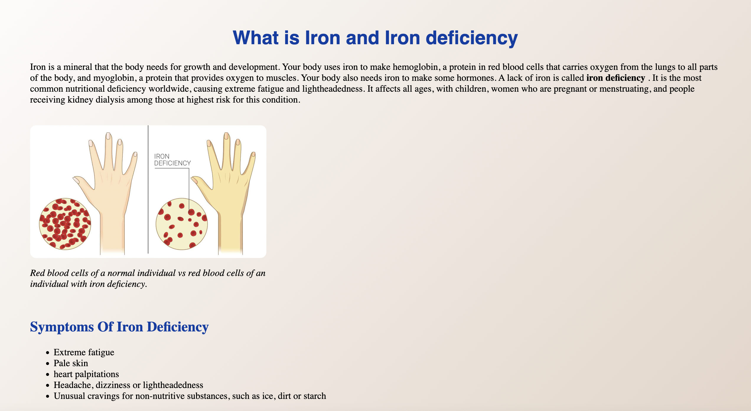 iron deficience project